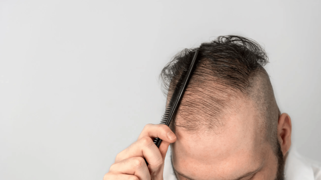 Hair loss img.