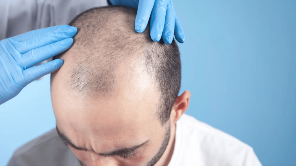 cancer on the scalp