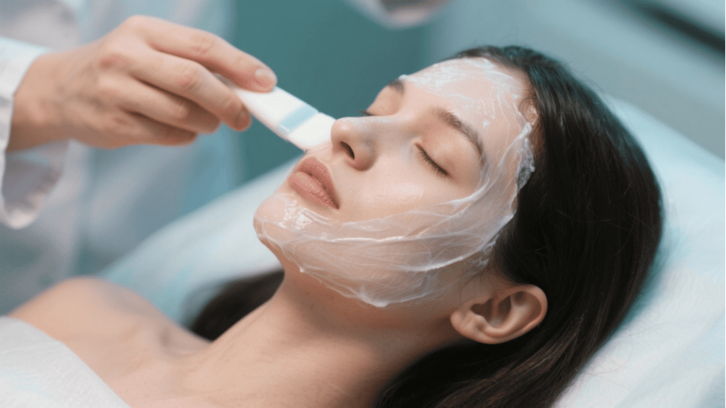 chemical peels