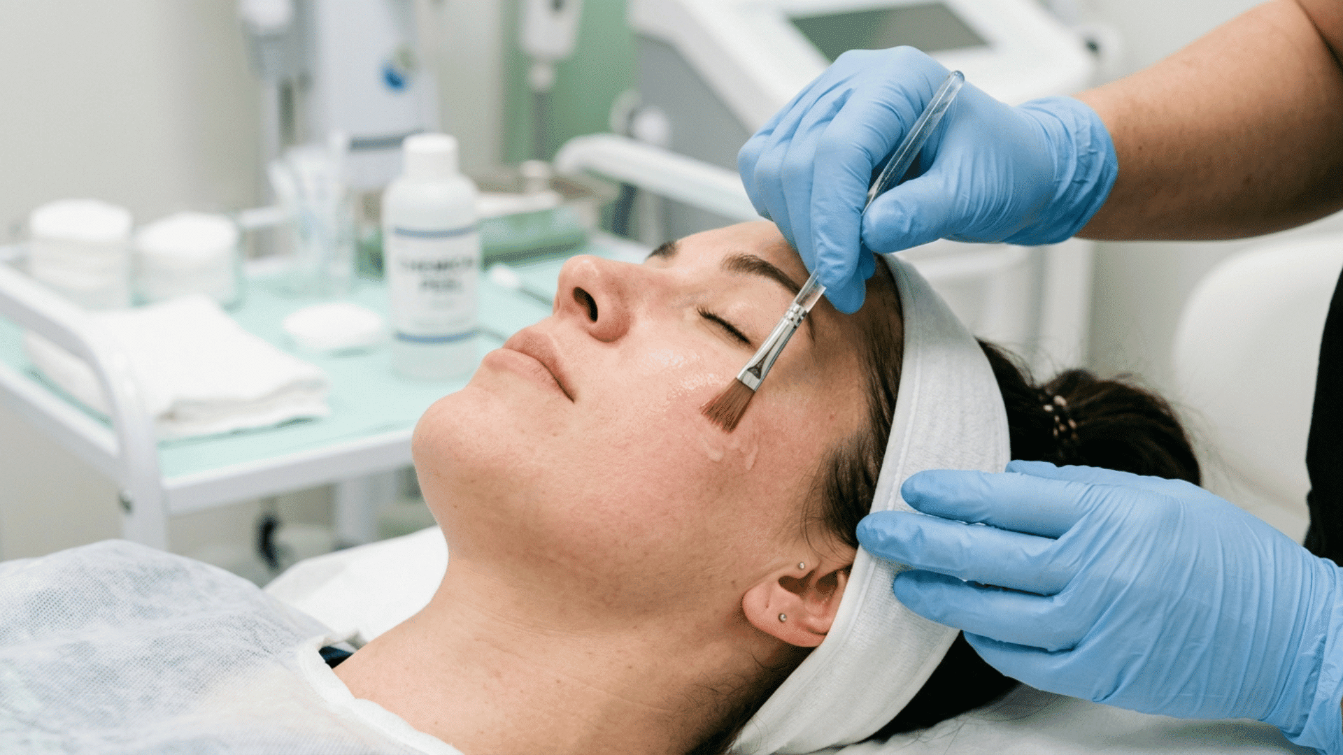 dermatologist applying a chemical peel solution to a patient's face during a skin treatment