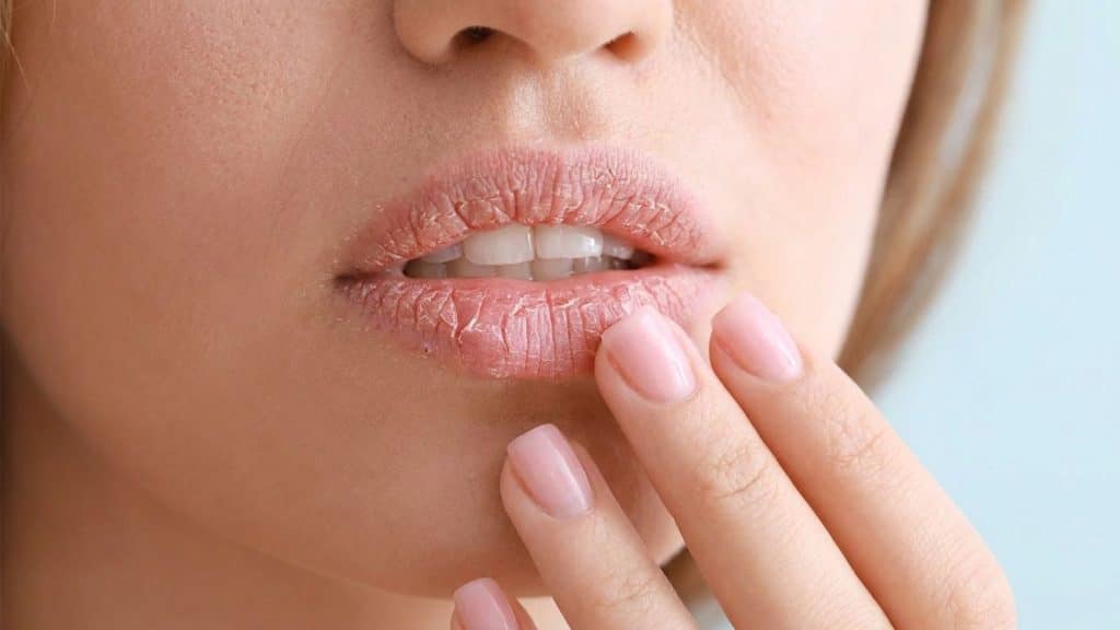 close-up of a woman touching dry lips that appear tight and uncomfortable from ongoing moisture loss