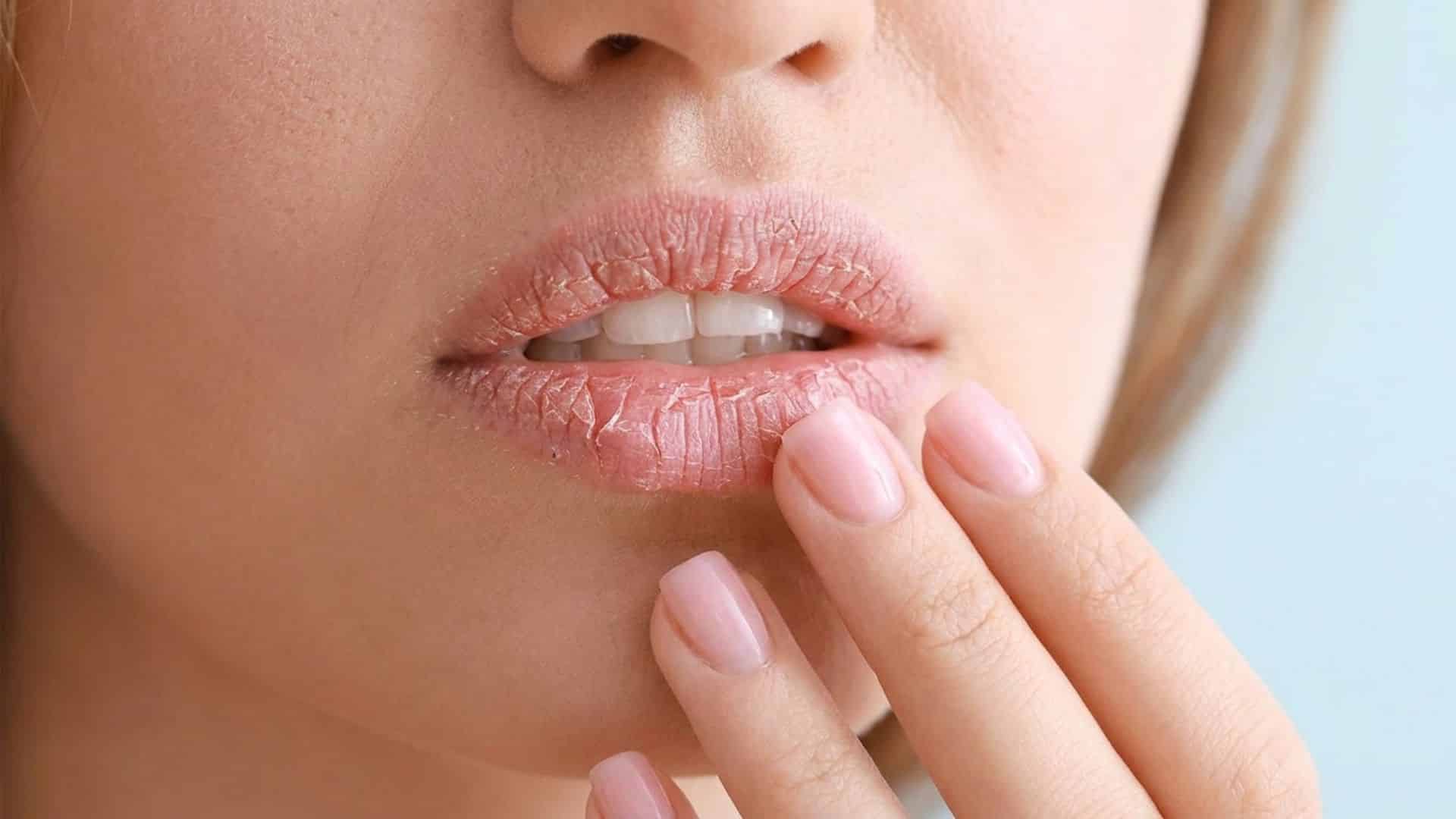 close-up of a woman touching dry lips that appear tight and uncomfortable from ongoing moisture loss