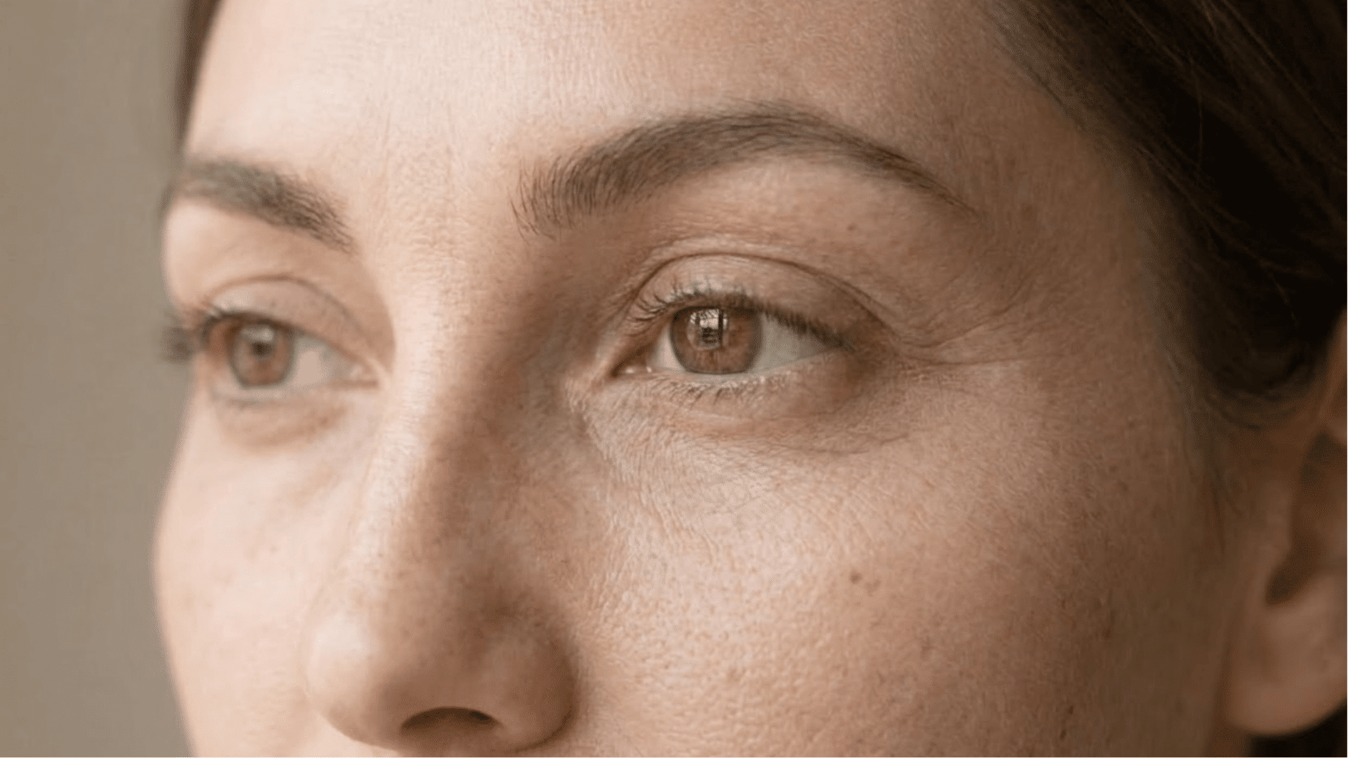 close-up of young woman's face showing fine lines under the eyes