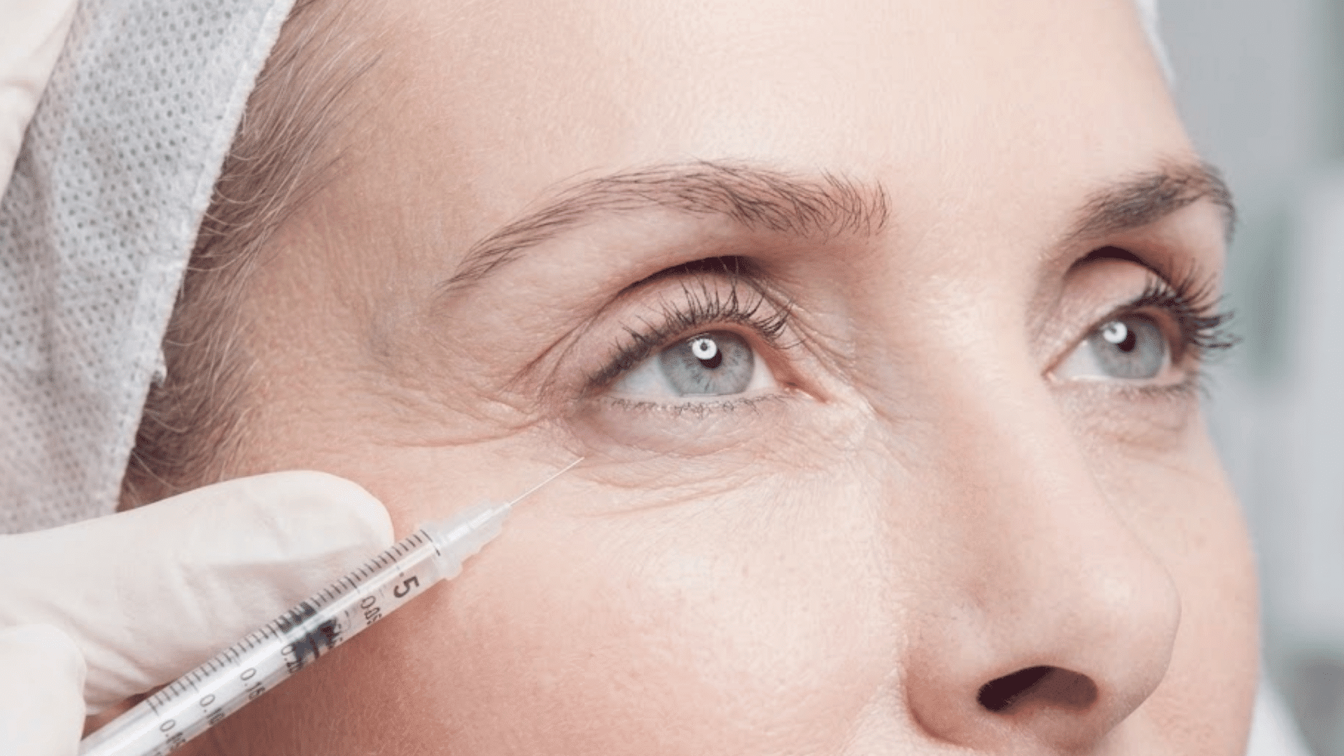 woman receiving an under-eye cosmetic injection to reduce fine lines and improve the appearance of wrinkles